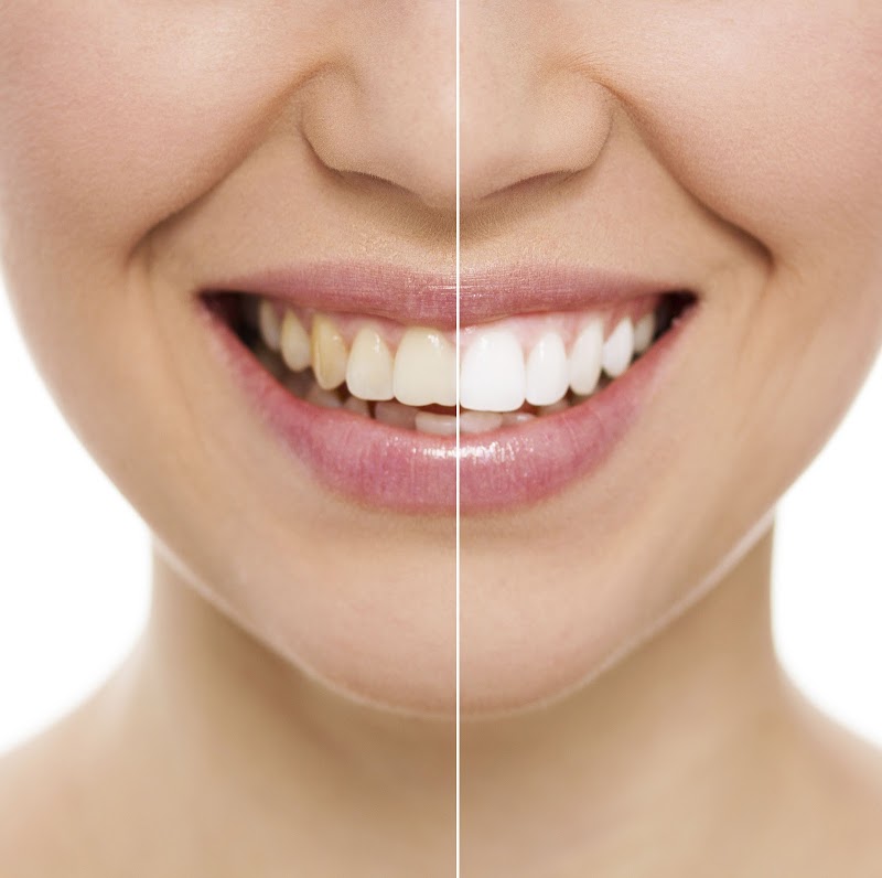 Precious Smiles Cosmetic Dentistry, Miami