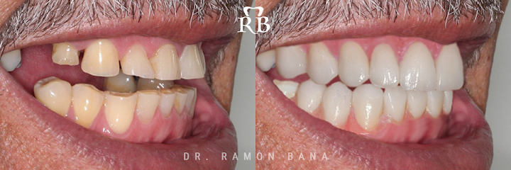 Ramon Bana, DDS - Miami Sedation & Cosmetic Dentistry
